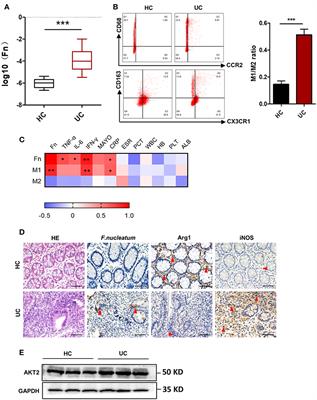 Fusobacterium nucleatum Aggravates the Progression of Colitis by Regulating M1 Macrophage Polarization via AKT2 Pathway